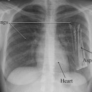 7 Reasons That We Should Grow Vegetables In Our Lungs
