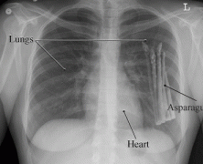 7 Reasons That We Should Grow Vegetables In Our Lungs
