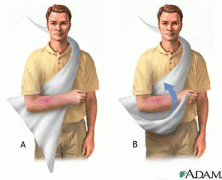 7 Reasons To Wear A Sling