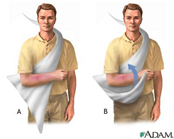 how to wear a sling