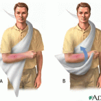 7 Reasons To Wear A Sling